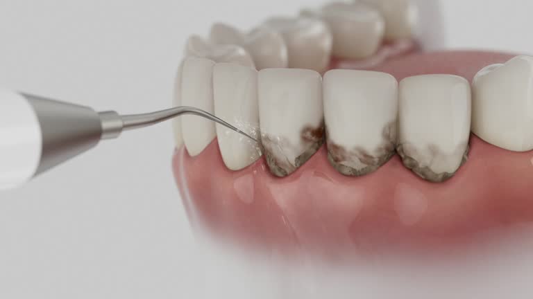 Trusted Tooth Extraction service in Cleveland, FL - Dentist Open Now
